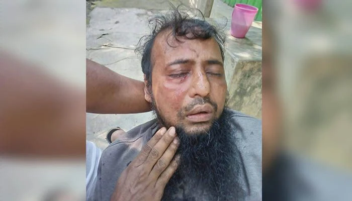 জামায়াত কর্মীকে হামলার অভিযোগ যুবদল কর্মীর বিরুদ্ধে