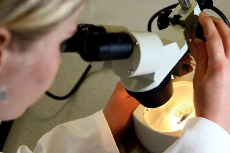 Algorithm study 90% accurate predicting bowel cancer