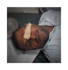 সাংবাদিককে কুপিয়ে জখম, রক্তাক্ত জখম বাদ দিয়ে অভিযোগ দিতে বললেন ওসি সালাউদ্দিন