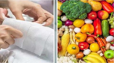 অগ্নিদগ্ধ রোগীদের জন্য পুষ্টিকর খাবার জরুরি: কী বলছেন পুষ্টিবিদরা?