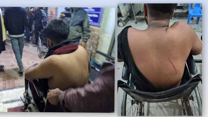 গণ বিশ্ববিদ্যালয়ের গকসু'র কার্যনির্বাহী সদস্য ক্যাম্পাসে দূর্বৃত্তের হামলার শিকার