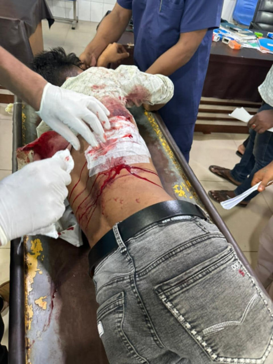 রূপগঞ্জে আধিপত্য বিস্তারকে কেন্দ্র করে যুবদল-ছাত্রদল সংঘর্ষে গুলিবিদ্ধসহ আহত ১০