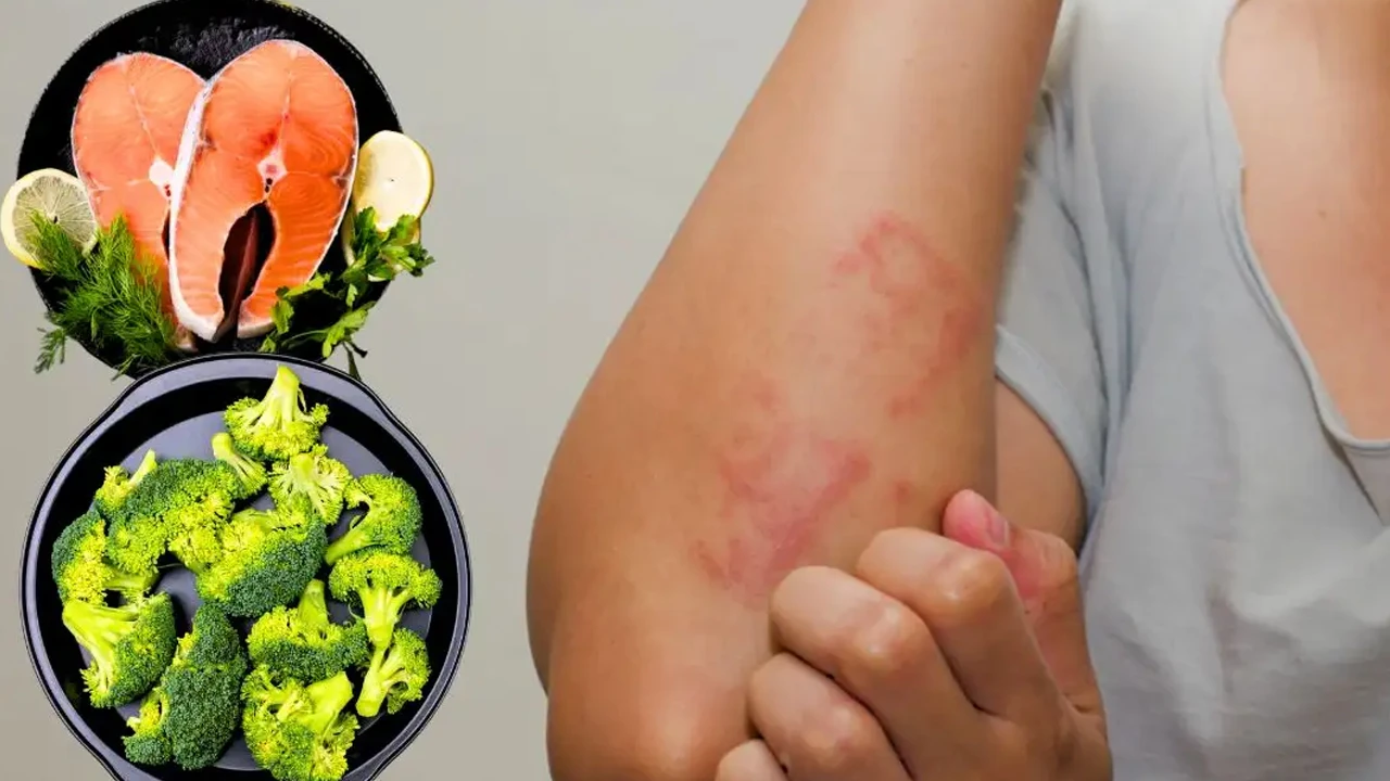 অ্যালার্জি থেকে সুরক্ষায় প্রতিদিনের খাদ্যতালিকায় রাখুন এই ৫ খাবার